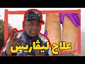 هاهو العلاج الطبيعي للدوالي ليڤاريس من عند خوكم الصحراوي