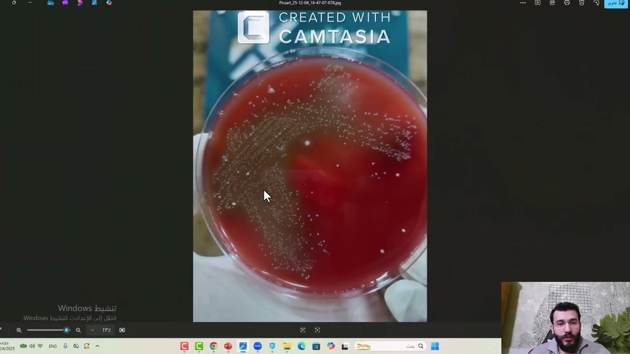 blood agar-الاغار الدموي