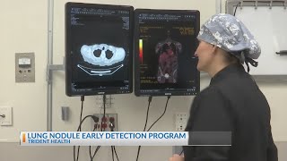 Lung Nodule Early Detection Program at Trident Medical Center