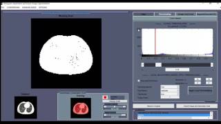 Histogram dependent technique image segmentation matlab projects