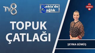 Topuk Çatlağı Neden Oluşur? Podolog Şeyma Gümüş 8De Sağlık
