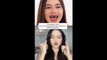 rara LIDA #fyp #reels #shorts #beranda #viralvideo #artisviral #trending #short #shortvideo