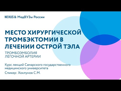 Место хирургической тромбэктомии в лечении острой ТЭЛА