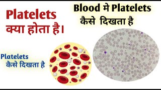 How to identify platelets I Platelet count in blood smear