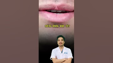 Niềng răng đón tết - niềng răng đẹp đón tết #nhakhoa #niengrang