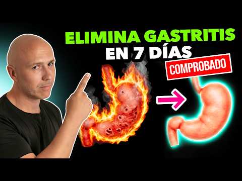 ELIMINA Definitivamente Tu GASTRITIS Y REFLUJO En 7 DÍAS Con Este SECRETO Médico REVELADO