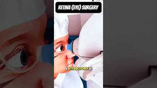Retina Surgery Explained|Vitrectomy Procedure in 3D #vitrectomy#retinasurgery