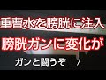 ❪重曹水を膀胱に注入❫ 膀胱癌を６回手術 次は摘出と言われ 重曹水をを膀胱に直接注入 カテーテルと注射器を使い膀胱を洗浄 すると大きな変化が！！