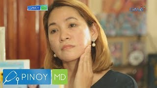 Pinoy MD: Solusyon sa acne scars, ano nga ba?