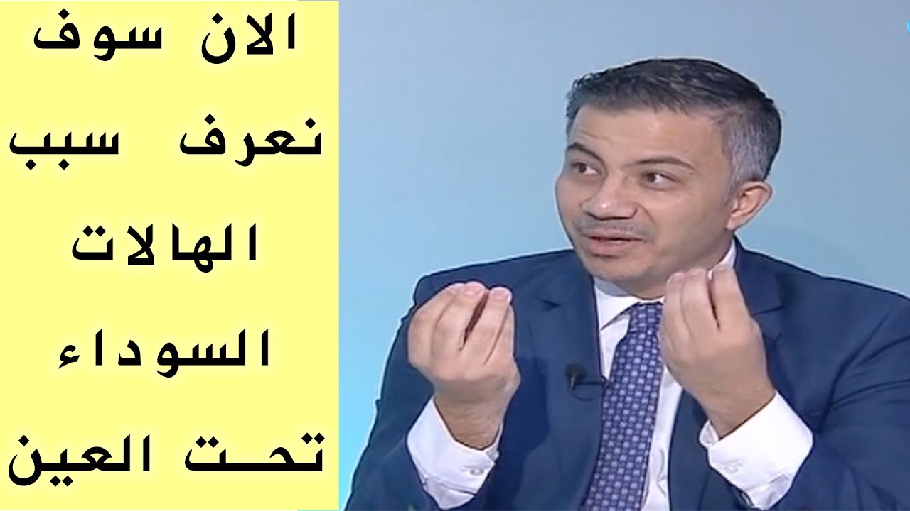 شرح مبسط لأسباب السواد حول العينين
