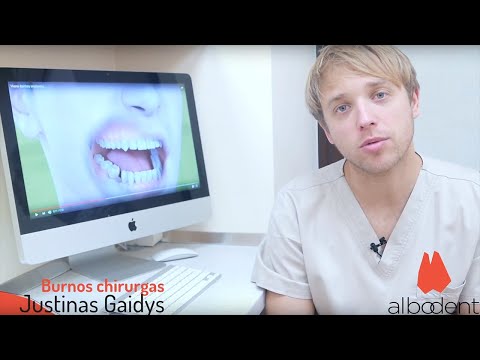 Video: Dantų chirurgija