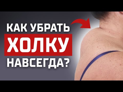 Любая Холка Уйдёт Навсегда! Два Шикарных Упражнения Уберут Вдовий Горб!