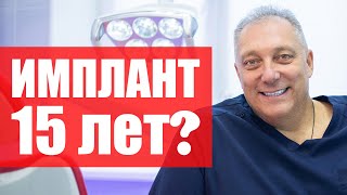 Как долго служат импланты зубов, срок службы зубных имплантов