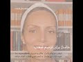 ماساژ برای رفع غبغب ماساژ برای رفع غبغب