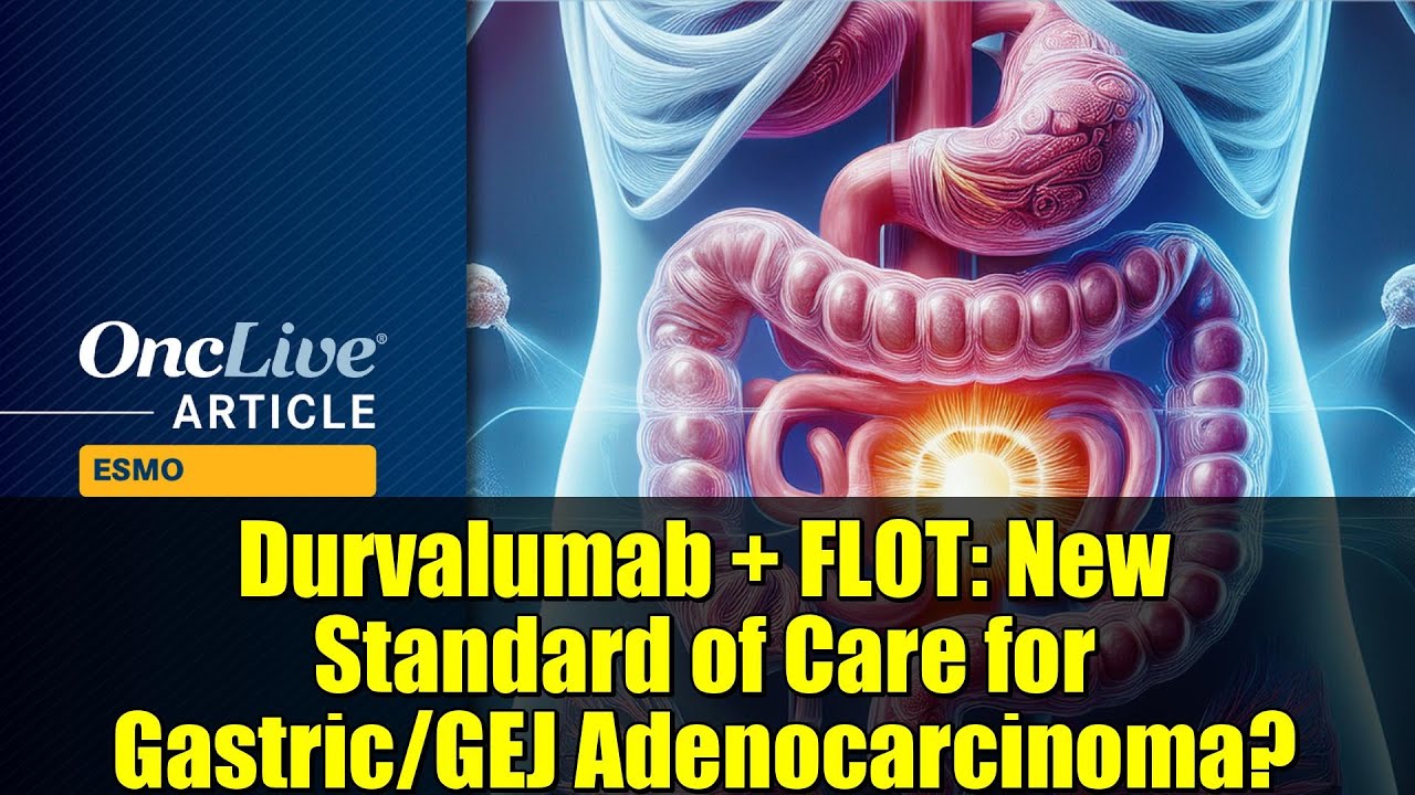 Durvalumab + FLOT: New Standard of Care for Gastric/GEJ Adenocarcinoma? | MATTERHORN Trial Results