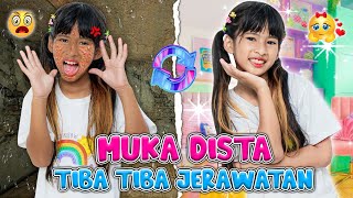 Muka Dista Tiba-Tiba Jerawatan Banyak Banget!! Kok Bisa Sebanyak Ini #Viralvideo #Trending