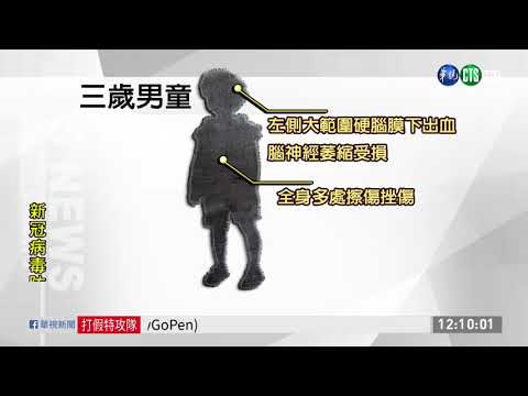 疑遭無照保母凌虐 男童腦傷成植物人｜華視新聞 20201229