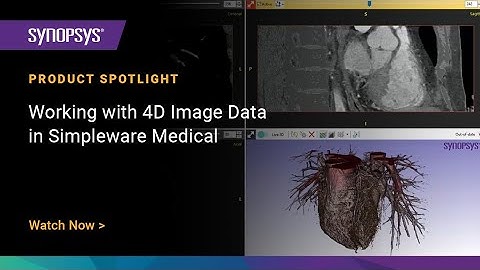 Working with 4D Image Data in Simpleware Medical