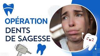 TOUT SAVOIR SUR UNE EXTRACTION DES DENTS DE SAGESSE (douleurs, nourriture...)