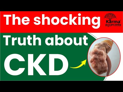The Shocking Truth about Chronic Kidney Disease Revealed | what is Chronic Kidney Disease