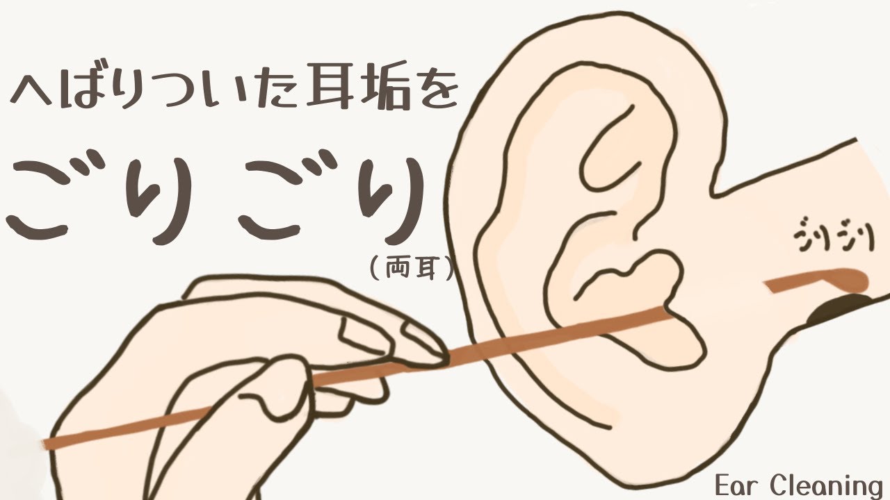 【ASMR】へばりついた耳垢をごりごりする耳かき（両耳） Ear Cleaning 【No Talking】