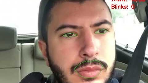 DROWSY DRIVER DETECTION