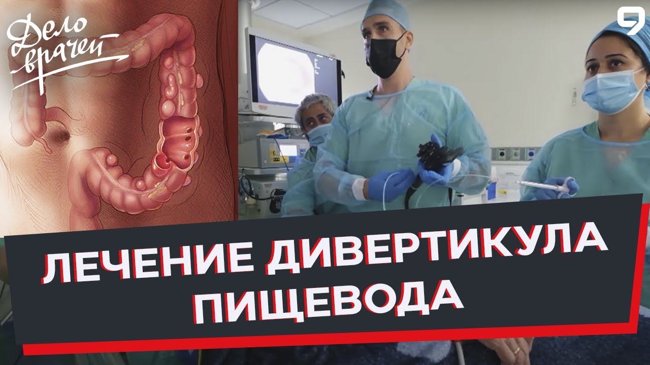 Дело врачей. Гастроэнтеролог Сергей Воско. Лечение дивертикула пищевода ...