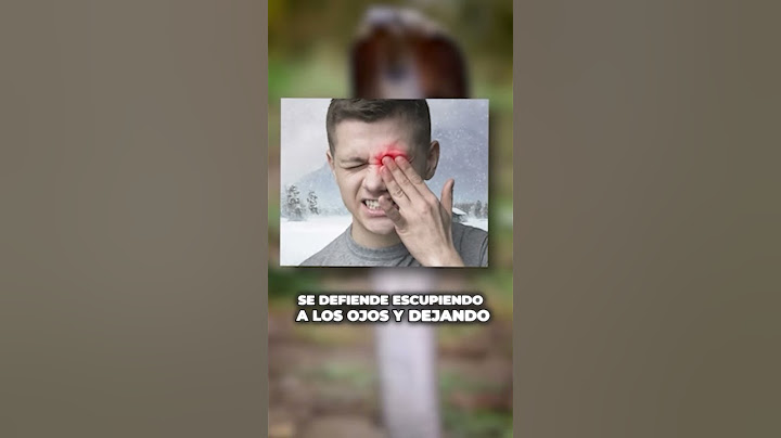 Frank Cuesta sobrevive a la mordedura de una cobra venenosa de milagro 💀🤔 #Shorts