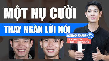 Niềng Răng - Một Nụ Cười Thay Ngàn Lời Nói | Nam Bùi Vinalign