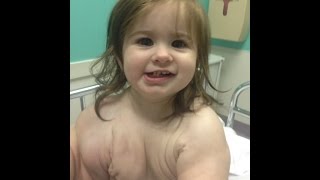 Madison’s Story: Battling a Vascular Malformation at Texas Children’s Hospital