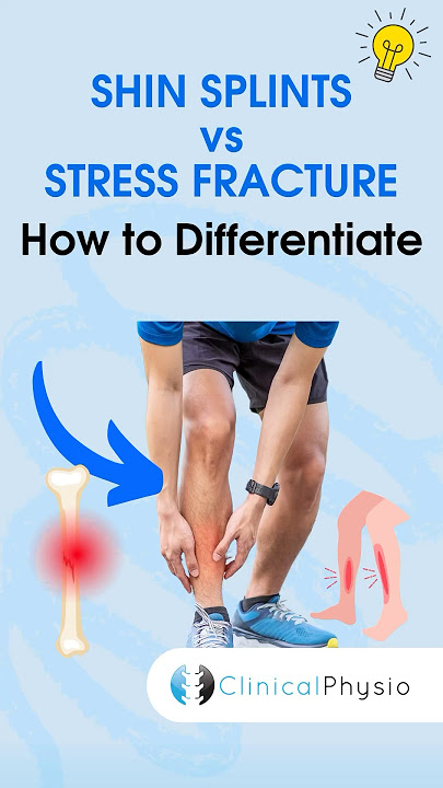 Shin Splints vs. Stress Fracture #physicaltherapy #physiotheraphy #shinsplints