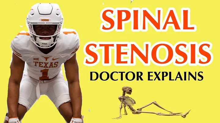 SPINAL STENOSIS | DOCTOR explains UT Longhorns DeG...