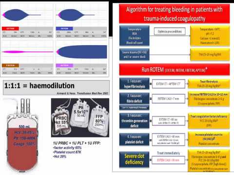 Video: Akutní Traumatická Koagulopatie A Trauma-indukovaná Koagulopatie: Přehled