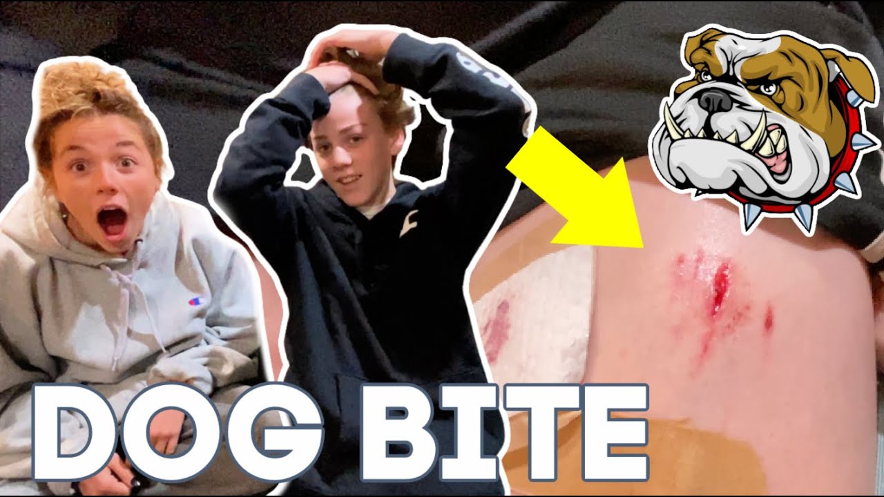 Attacked By His Girlfriend's Dog | Living Room Makeover Begins!