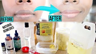 How To Lighten Dark Lips Permanently & Naturally Easy Lip Balm Recipe Inside