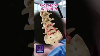 Facet Joint Injection Purpose & Procedure Explained