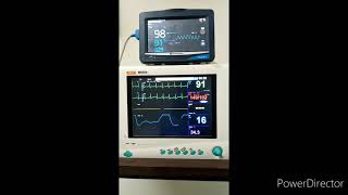 كيفية قراءة العلامات الحيويه(v/s) من جهاذ المونتر