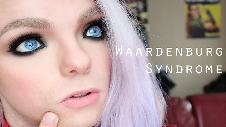 My Face: Waardenburg Syndrome