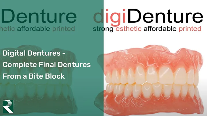Digital Dentures – Complete Final Denture from a Bite Block in 2 Appointments