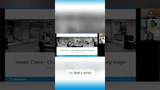 CT Data Analysis with ImageJ Viewer's Choice!