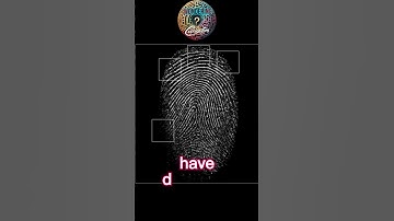 Unique Fingerprint Patterns #fact #fingerprint #pattern
