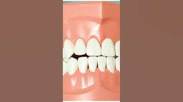 Bone loss after Tooth Extraction. Is a bone graft after extraction for a dental implant? #implant