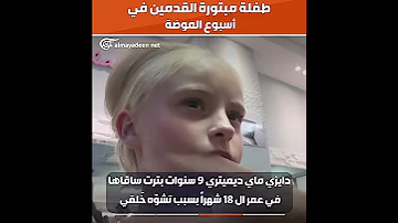طفلة مبتورة الساقين تشارك في أسبوع الموضة 
