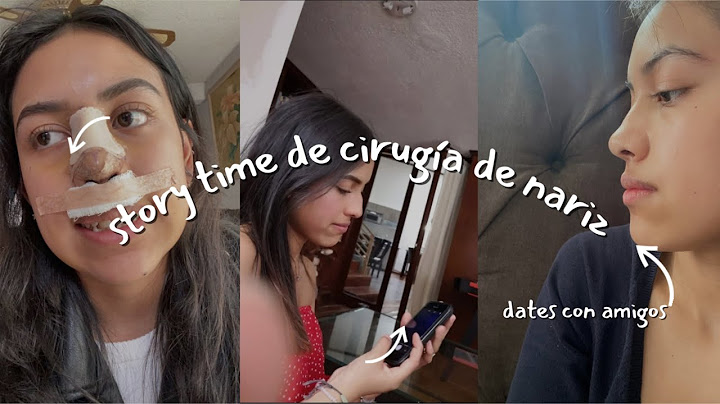 ¡Me opere la Nariz! ¿Fue todo lo que esperaba?