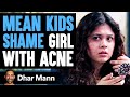 MEAN KIDS Shame Girl With ACNE, What Happens Next Is Shocking | Dhar Mann