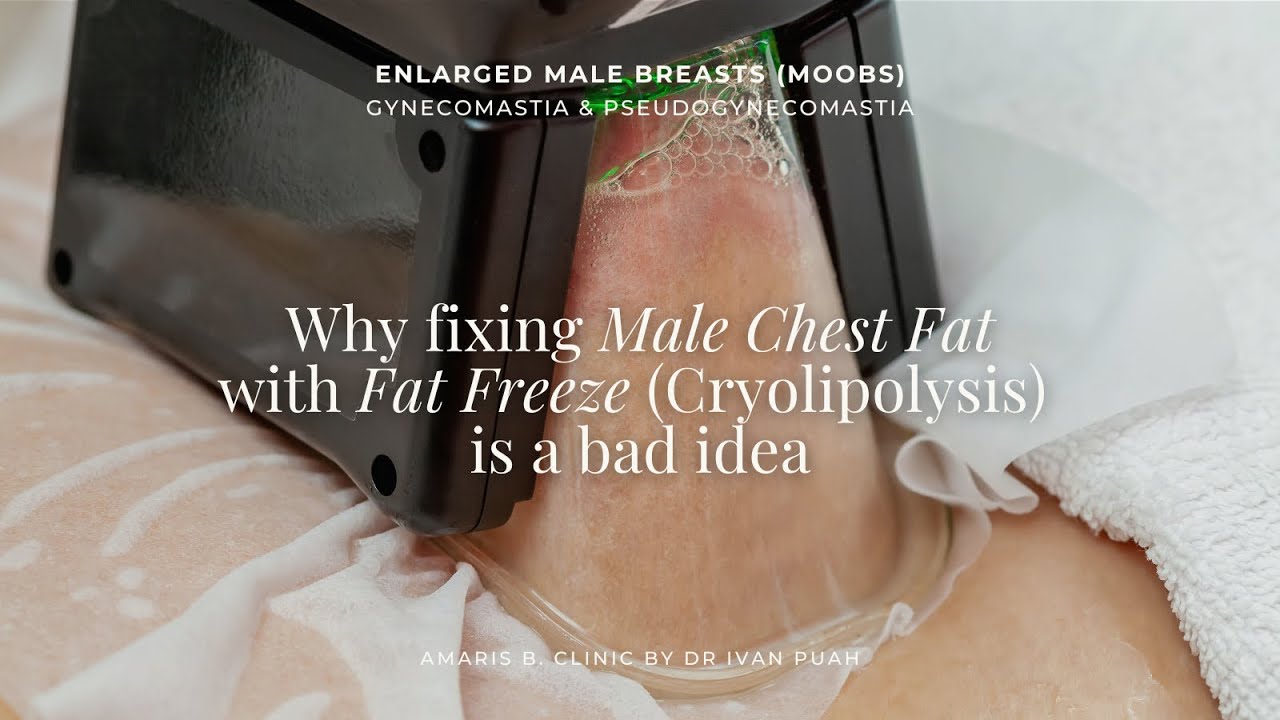 Why Fixing Male Chest Fat with Fat Freeze (Cryolipolysis) is a Bad Idea