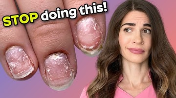 Remove Acrylic Nails Like A PRO Without Damaging Your Nails