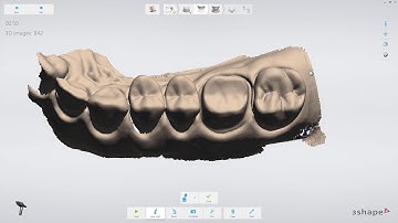3Shape TRIOS - Crown Workflow IT