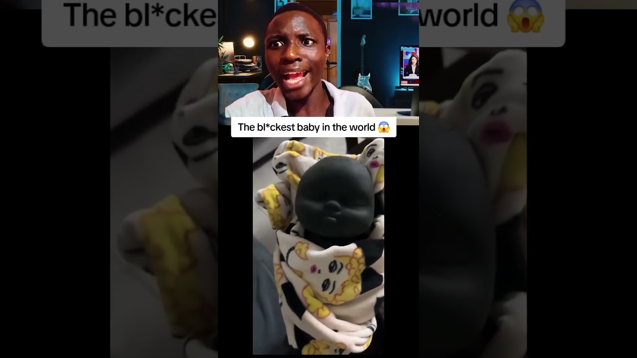 The blackest baby in the world