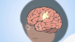 Transforming tumor surveillance with 3-dimensional phenotyping